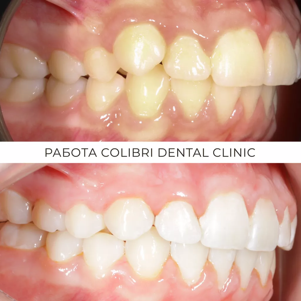 cases-colibri-dental-lusine.png cases-colibri-dental-lusine.png