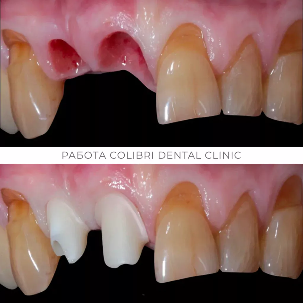 mednikov-colibri-dental.png