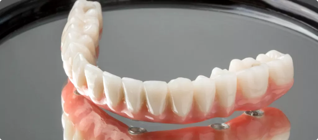 protesirovaniye-pod-narkozom-v-colibri-dental-24.png protesirovaniye-pod-narkozom-v-colibri-dental-24.png