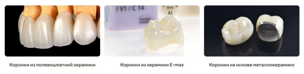 Different crowns.jpg