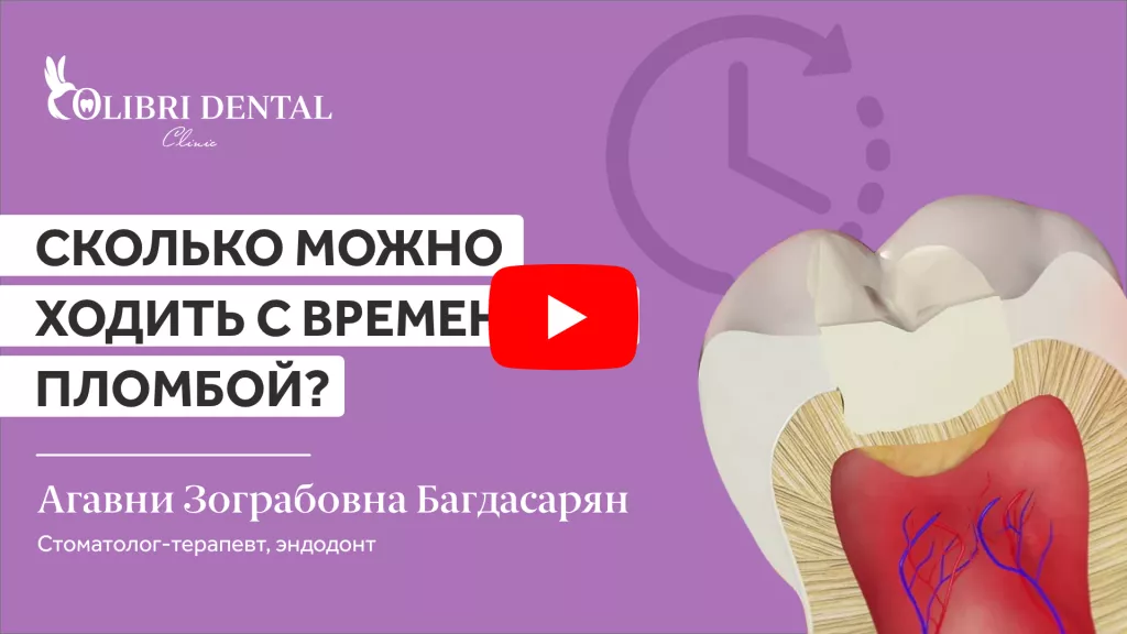Skolko-mozhno-hodit-s-vremennoy-plomboy.png