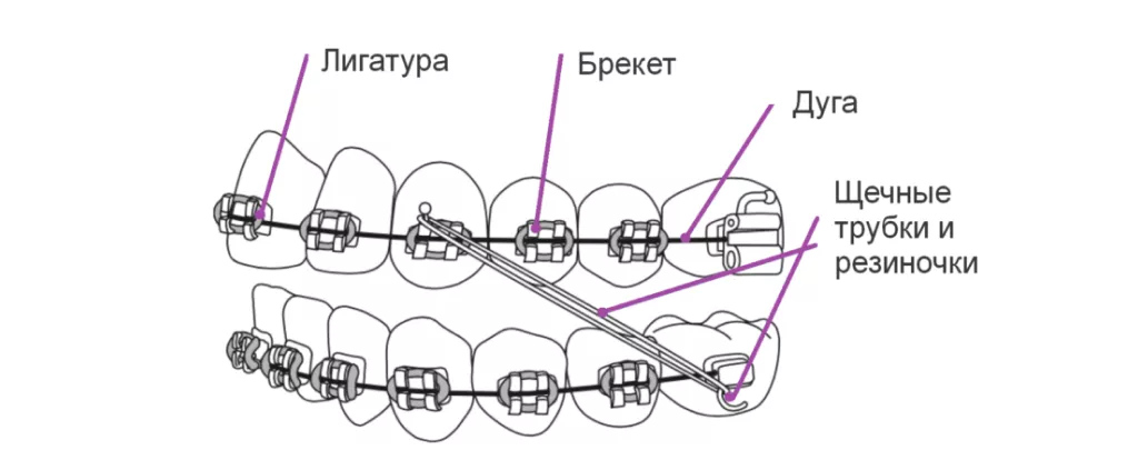 chasti-breket-sistemi.png chasti-breket-sistemi.png