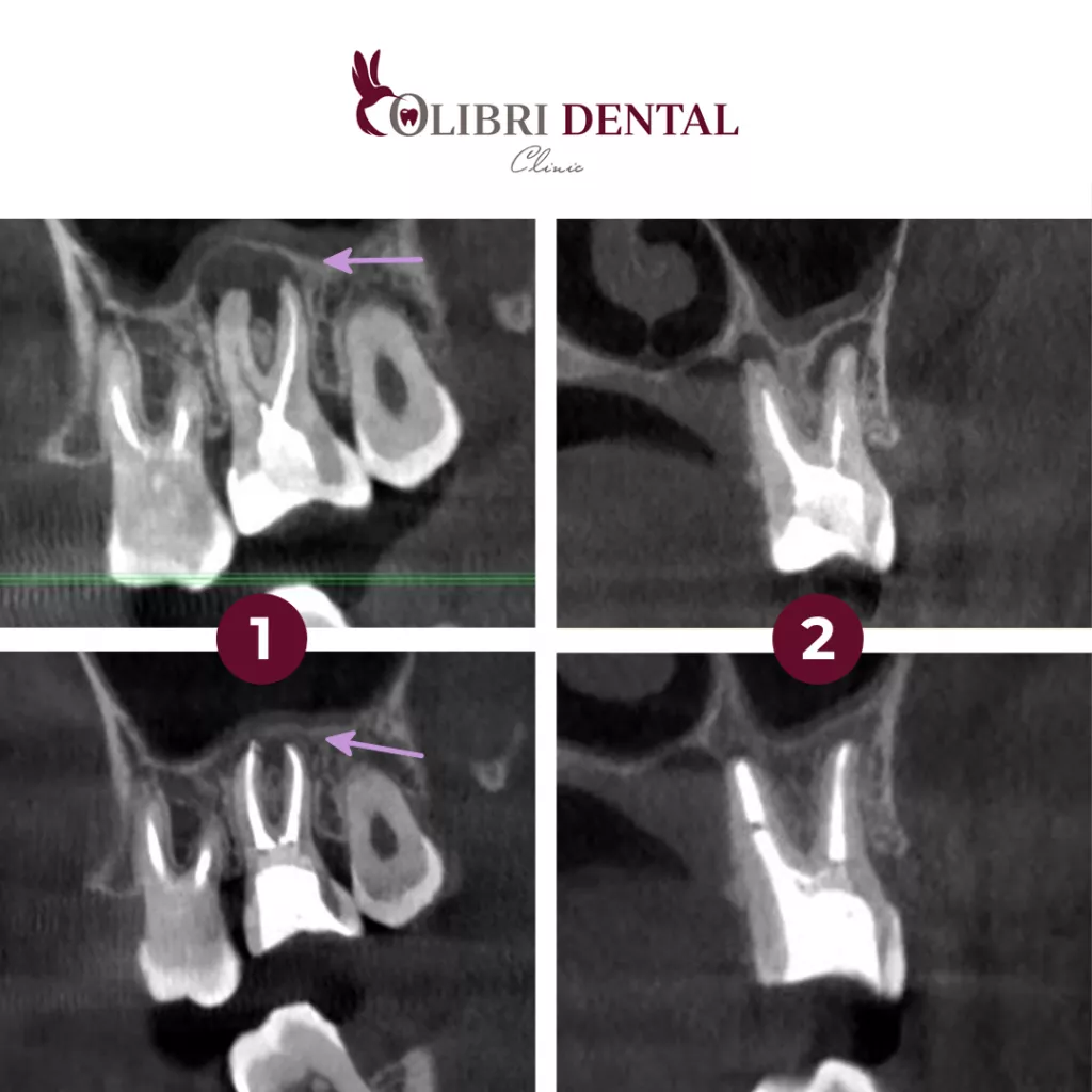 colibri-dental-karpova.png