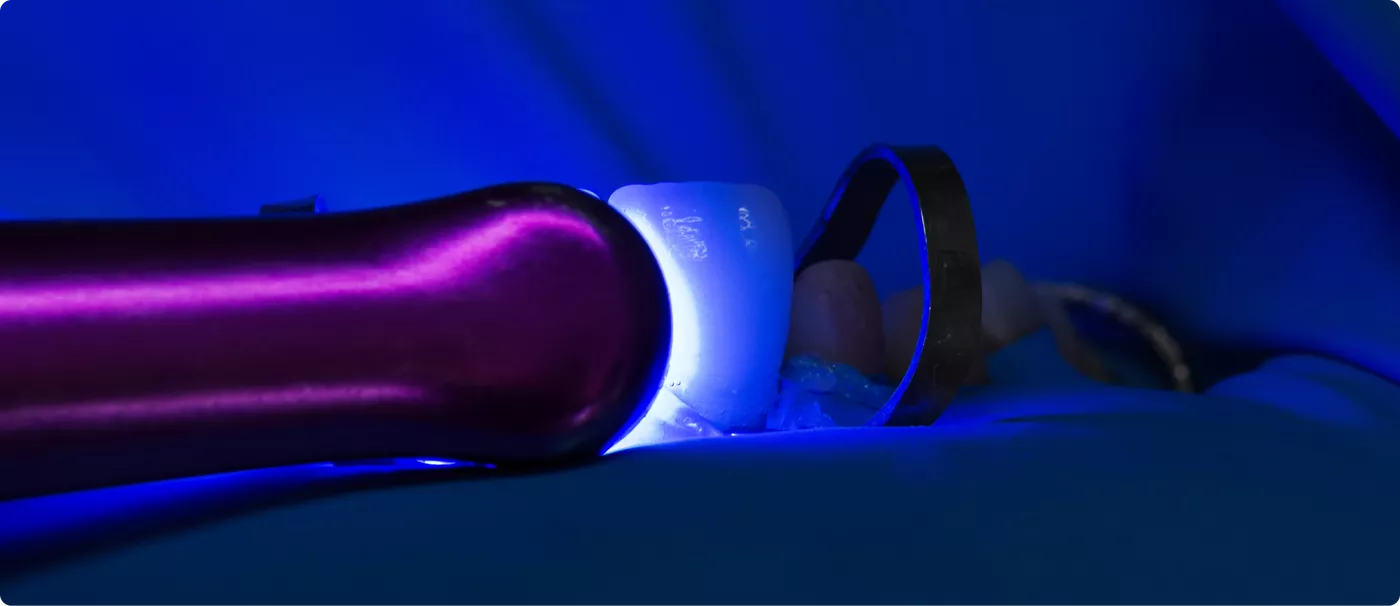 2keramicheskiye-viniri-colibri-dental.png