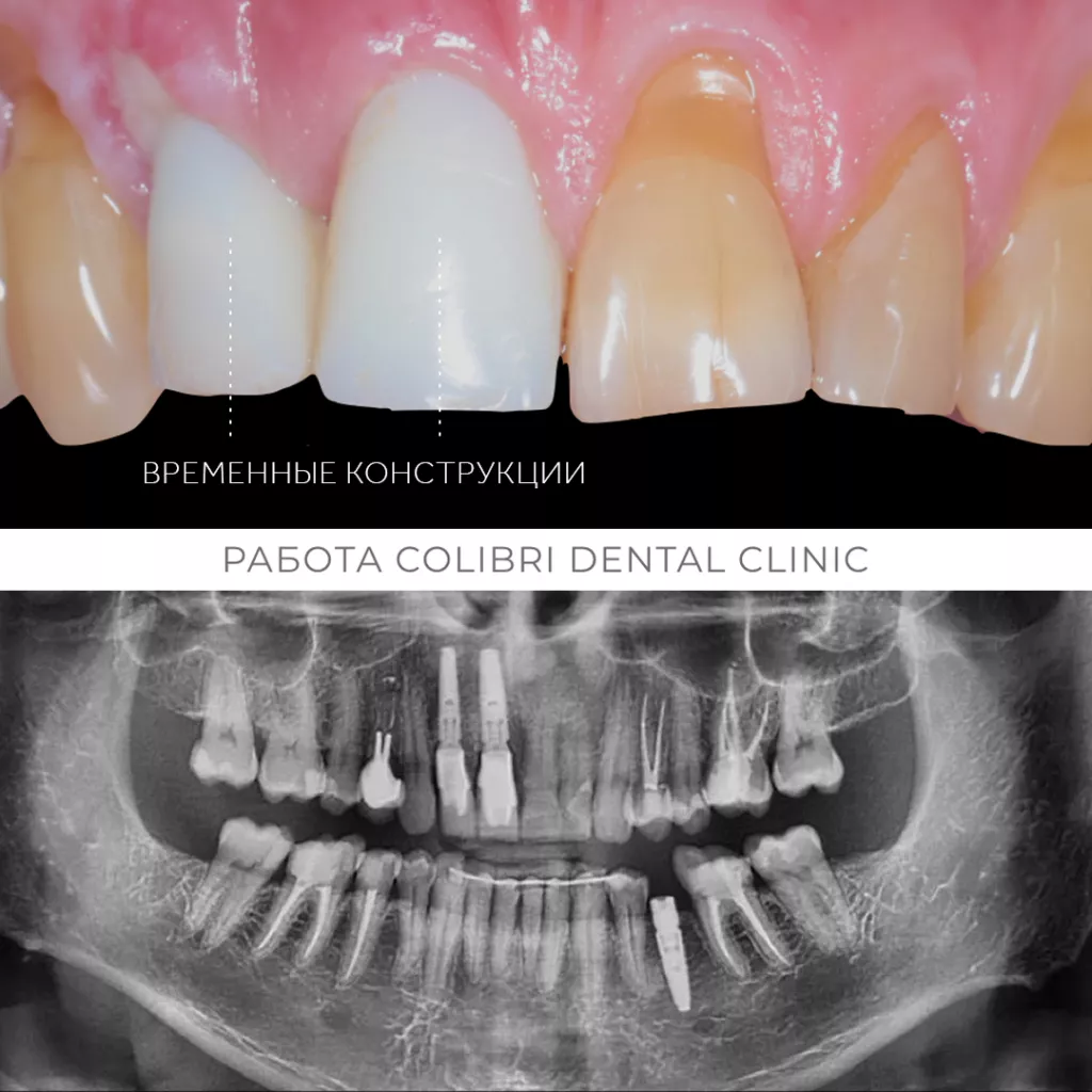 mednikov-case-colibri-dental.png